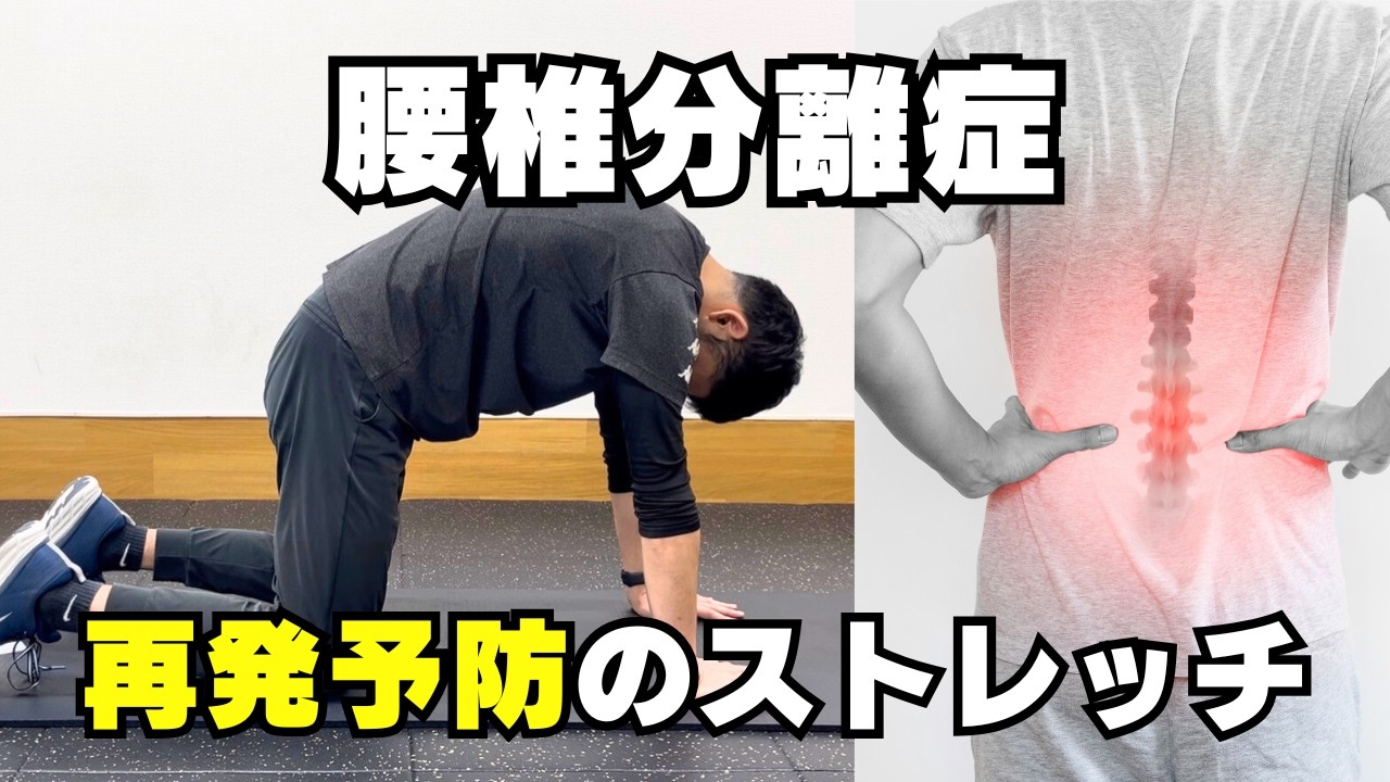 【腰椎分離症】再発予防のストレッチ