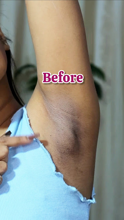 Bye bye to dark underarms ✨️🎀  #shorts #youtube #ytshorts #trending ##trend ##viral #skincare #short