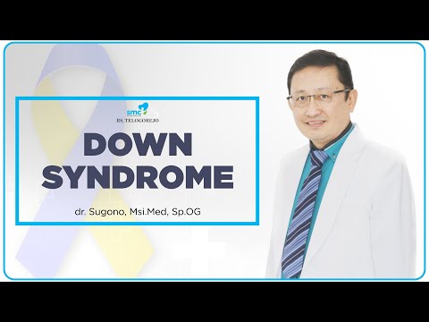 Video: Down Syndrome: Penyebab, Jenis, Dan Gejala