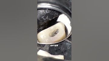 Stop Missing the MB2 Canal! Endodontic Tips That Work #drbogdanmoldoveanu #endodontiecupasiune