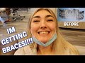 GETTING BRACES AT 21!!!! *HUGE OVERBITE* INVISALIGN OR TRADITIONAL BRACES? COST, EXPERIENCE