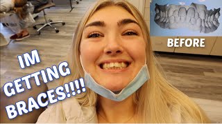 GETTING BRACES AT 21!!!! *HUGE OVERBITE* INVISALIGN OR TRADITIONAL BRACES? COST, EXPERIENCE