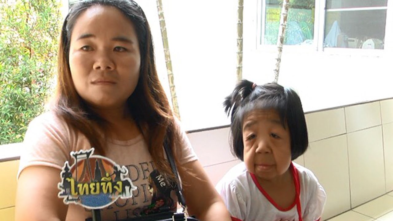 เด็ก 8 ขวบ เหมือนคนแก่อายุ 80