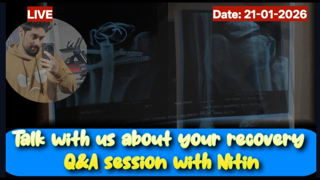 LIVE Q&A #21-2026: Tibia/Femur Fracture– Bone Healing Knee Bending Recovery Tips @SurvivalWithNitin