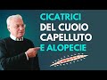 Cicatrici del cuoio capelluto ed alopecie: trapianto ed espansione cutanea