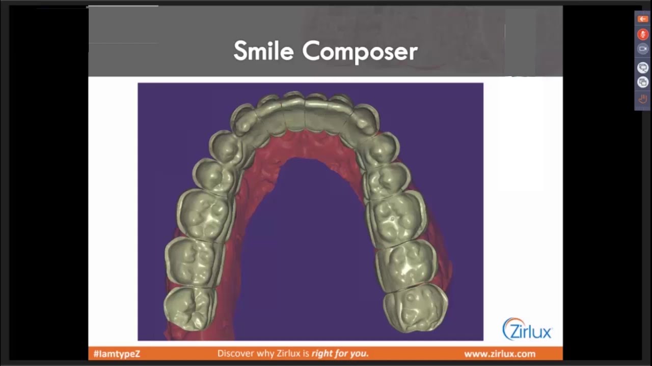 Zirlux Acetal Step-By-Step with Kris Schermerhorn, CDT