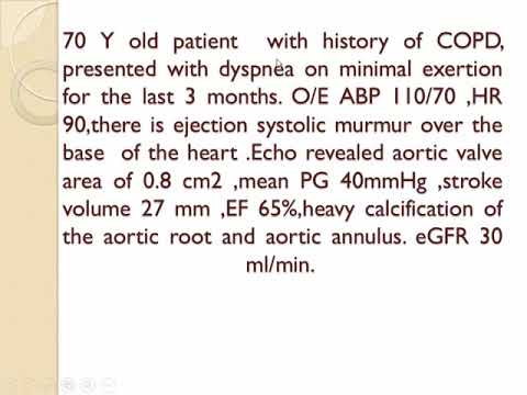 Valvular heart disease revision   Dr Ahmed kadry