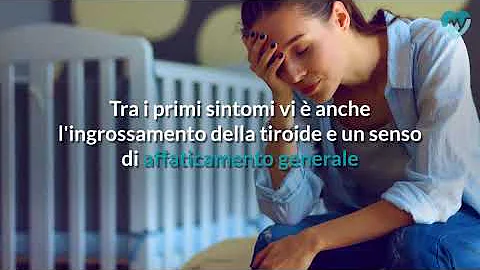 Cosa causa il morbo di Basedow?