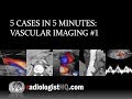 5 Cases in 5 Minutes: Vascular #1