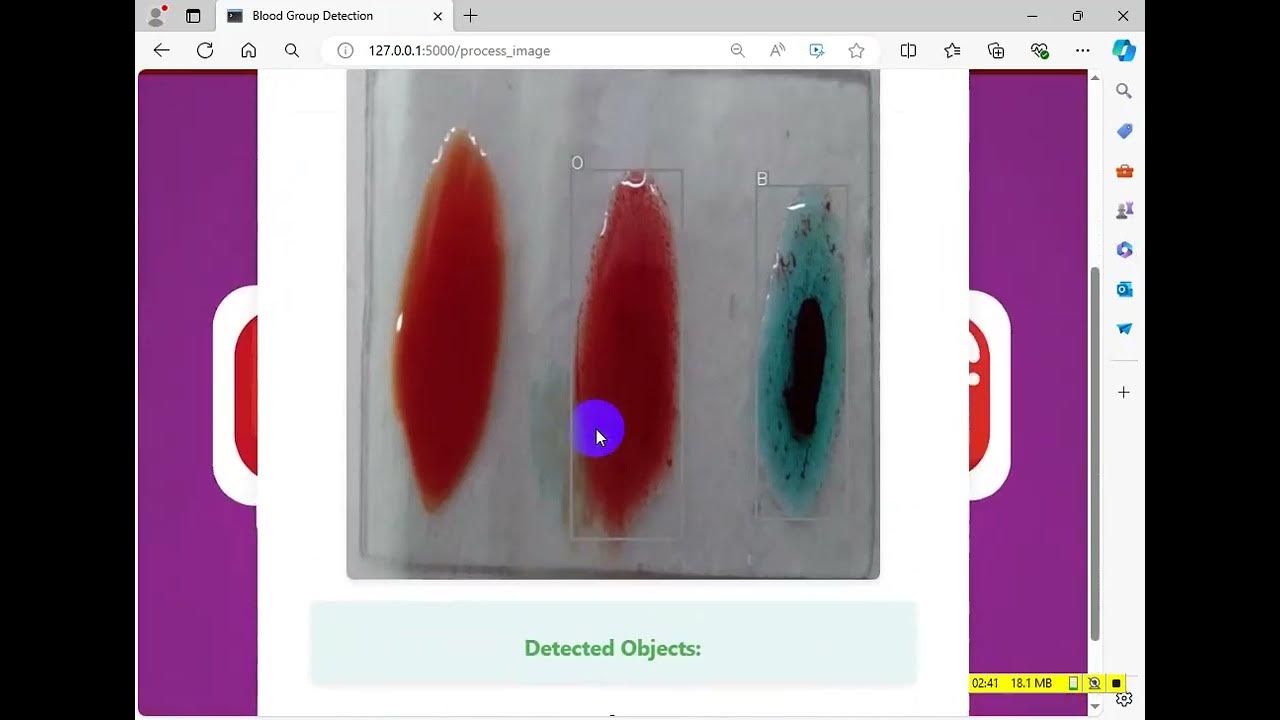 BLOOD GROUP DETECTION USING IMAGE PROCESSING Yolov8 - YouTube