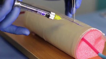 Infiltrating a Wound with Local Anesthetic before Suturing