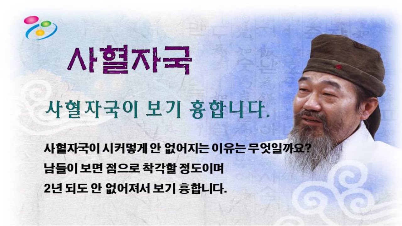사혈자국 - 심천사혈요법 창시자 박남희선생님의 라이브특강 - YouTube