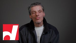 Homeless and alone in Toronto, he’s determined to get his old life back | Before & After