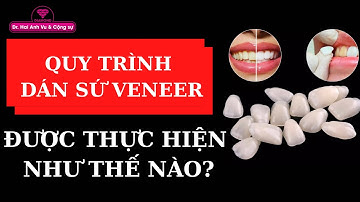 Qui trình dán sứ veneer được thực hiện như thế nào | Tt niềng răng quốc tế Diamond