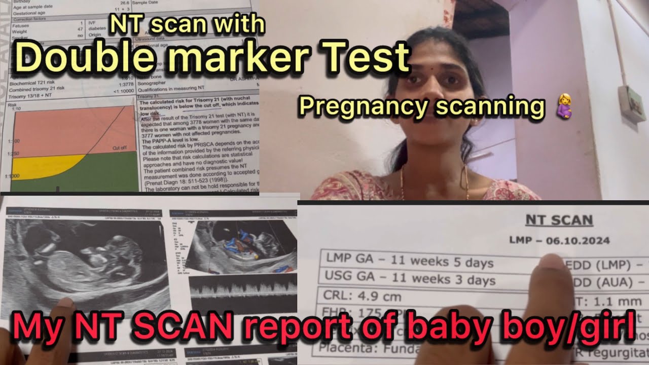 NT SCAN WITH DOUBLE MARKER Test FULL DETAILS