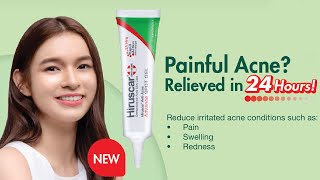 Relieve Painful Acne with Hiruscar Anti-Acne Advance Spot Gel