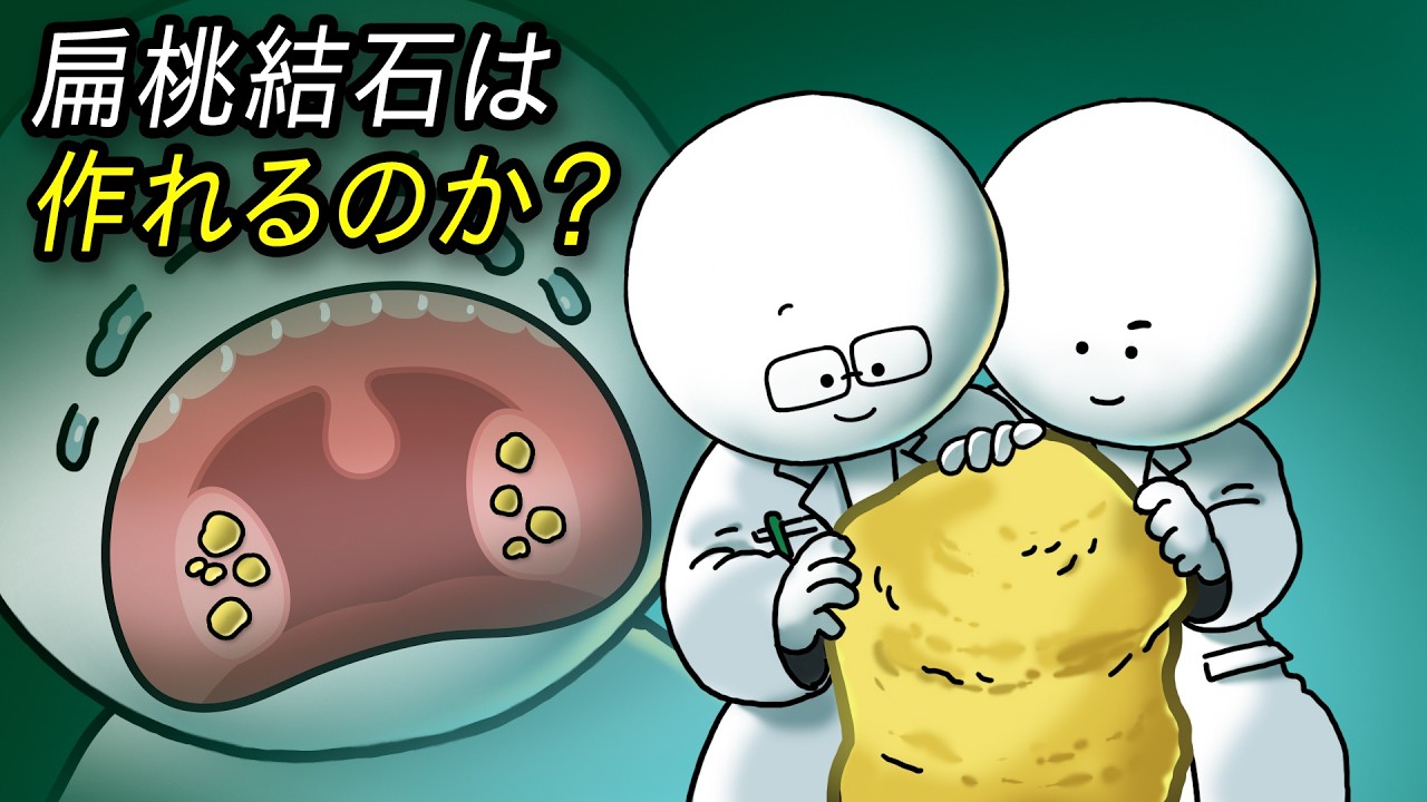 扁桃結石はどうしてできるの?
