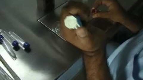 In Vitro Fertilization (IVF) Procedure (Part 2)