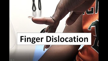 Severe Finger Dislocation Emergency