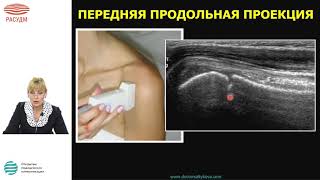 Алгоритм УЗИ плечевого сустава. Стандарты сканирования. Диагностика острой травмы плечевого сустава
