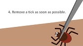 Four Tricks to Save Yourself From Ticks - YouTube