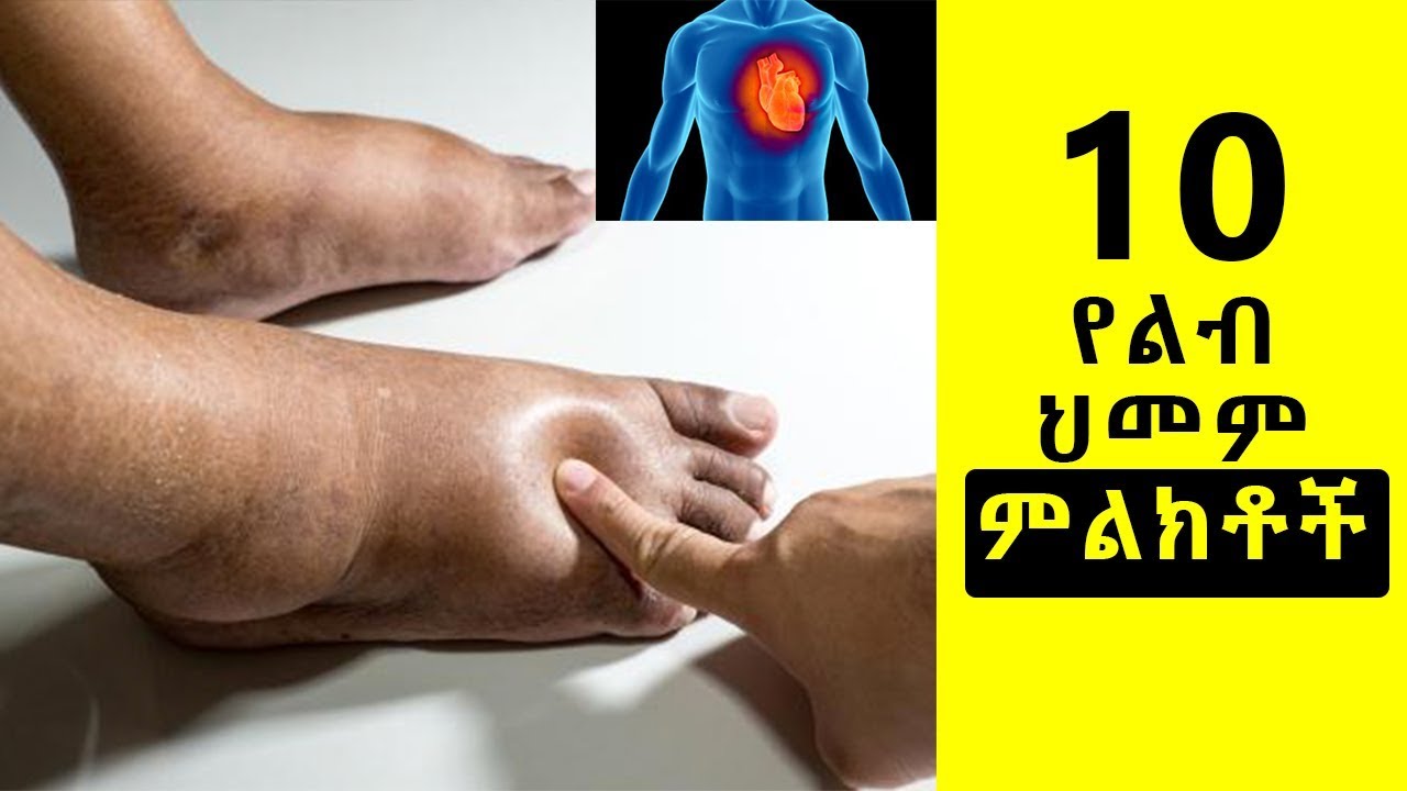 Ethiopia | ከአንድ በላይ ምልክቶች ካሉ ቶሎ ህክምና ያግኙ