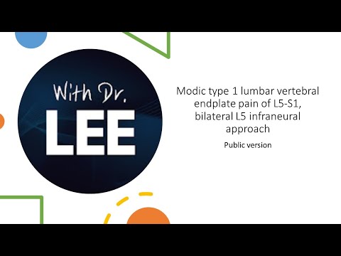 Modic type 1 lumbar vertebral endplate pain of L5-S1, bilateral L5 infraneural approach_56704