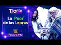 Cuál es la PEOR de las LEPRAS? │Parashat: TAZRÍA│ Uziel García