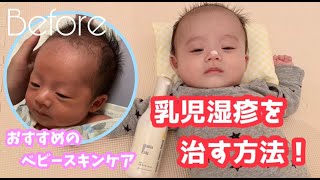 赤ちゃんのスキンケア 〜乳児湿疹を治した方法〜【育児Vlog】