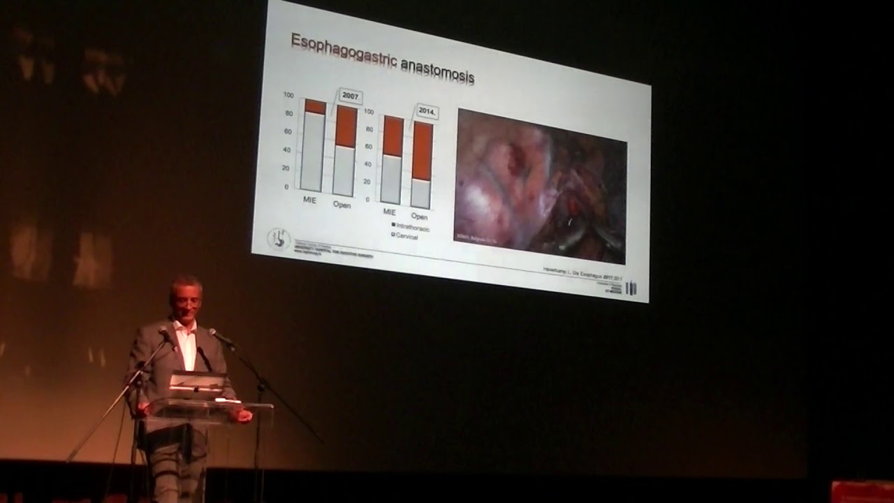 Milos Bjelovic Laparoscopic esophageal surgery 8. PCWS YouTube