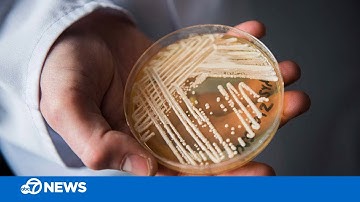 Drug-resistant fungus spread at an alarming rate in 2021, study says