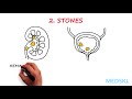 Urology Hematuria By Sandip Prasad M D Urology Hematuria By Sandip Prasad M D
