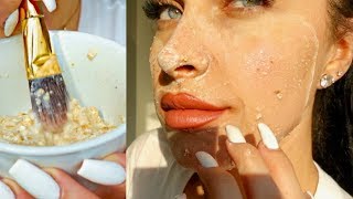 Diy face mask for clear skin | how to get rid of pimples + acne
overnight where find men :) instagram
http://www.instagram.com/anitasamantha blog http://w...