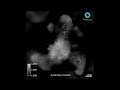 Mouse Small Intestinal Organoid, 5 days Time lapse + Z scanning - Label free 3D Live Cell Imaging