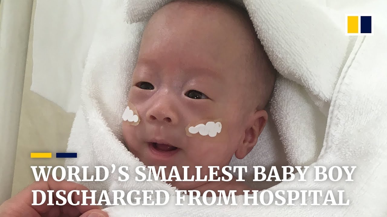 guinness world records smallest baby