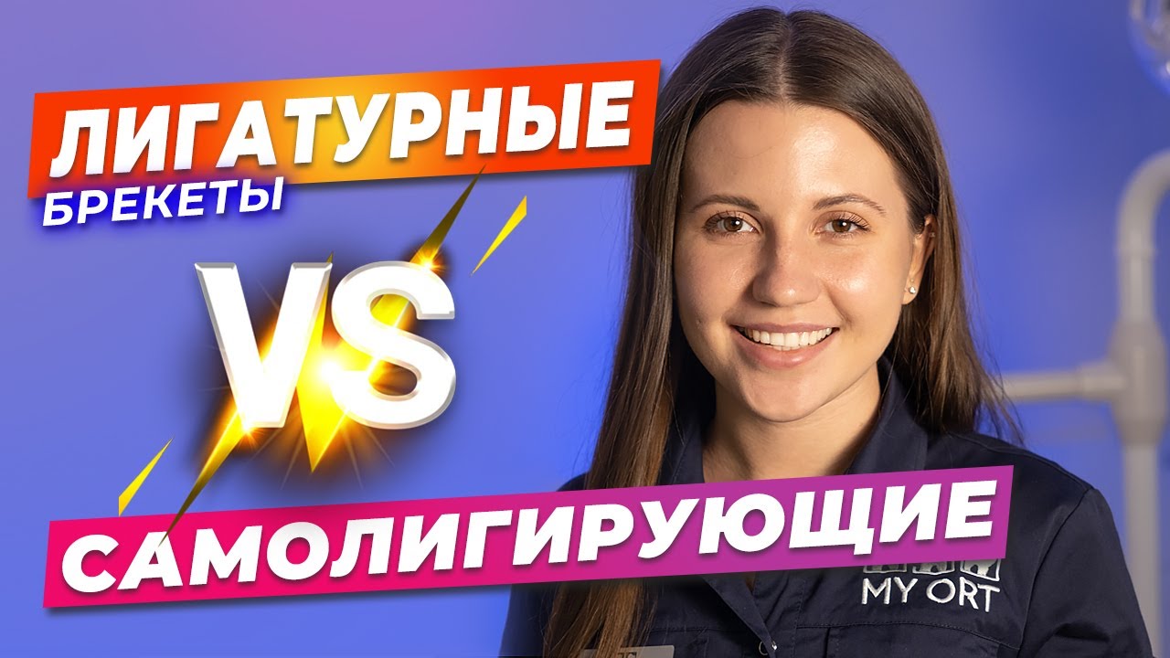 Лигатурные VS самолигирующие брекеты. Отличия простыми словами. #стоматология #стоматолог #брекеты