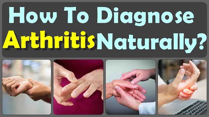 Top Ten Natural Treatments For Psoriatic Arthritis and Foods To Fight Arthritis