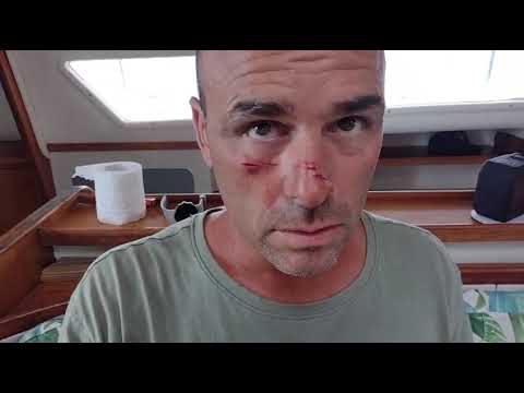 ⁣Drone Accident. Drones are DANGEROUS!