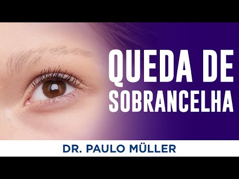 Queda de Sobrancelha – O que pode ser? – Dr. Paulo Müller Dermatologista.