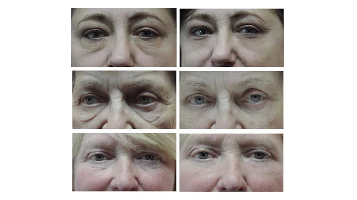 Instantly Ageless by Jeunesse