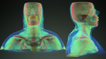 Volume Rendering of CT scan