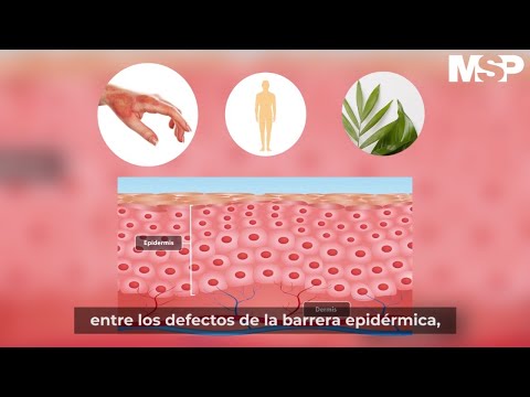 ¿Qué es la dermatitis atópica?