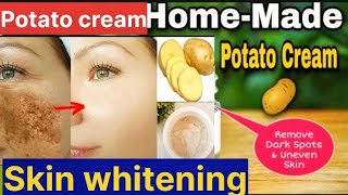 Skin Whitening potato cream|Remove dark spots, pigmentation, Wrinkles free face cream @voiceofkubra