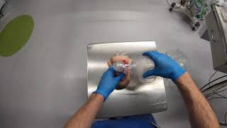 How a Bag Valve Mask Works