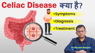 Celiac Disease क्या है? जाने इस बिमारी के लक्षण | Diagnosis and Treatment | Foods to avoid in Celiac