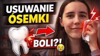 WYRWAŁAM ÓSEMKĘ🦷