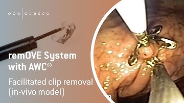 remOVE & AWC® | Facilitated clip removal (in-vivo model)