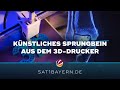 Knochen aus dem 3D-Drucker: Hoffnung für Sprunggelenk-Patienten