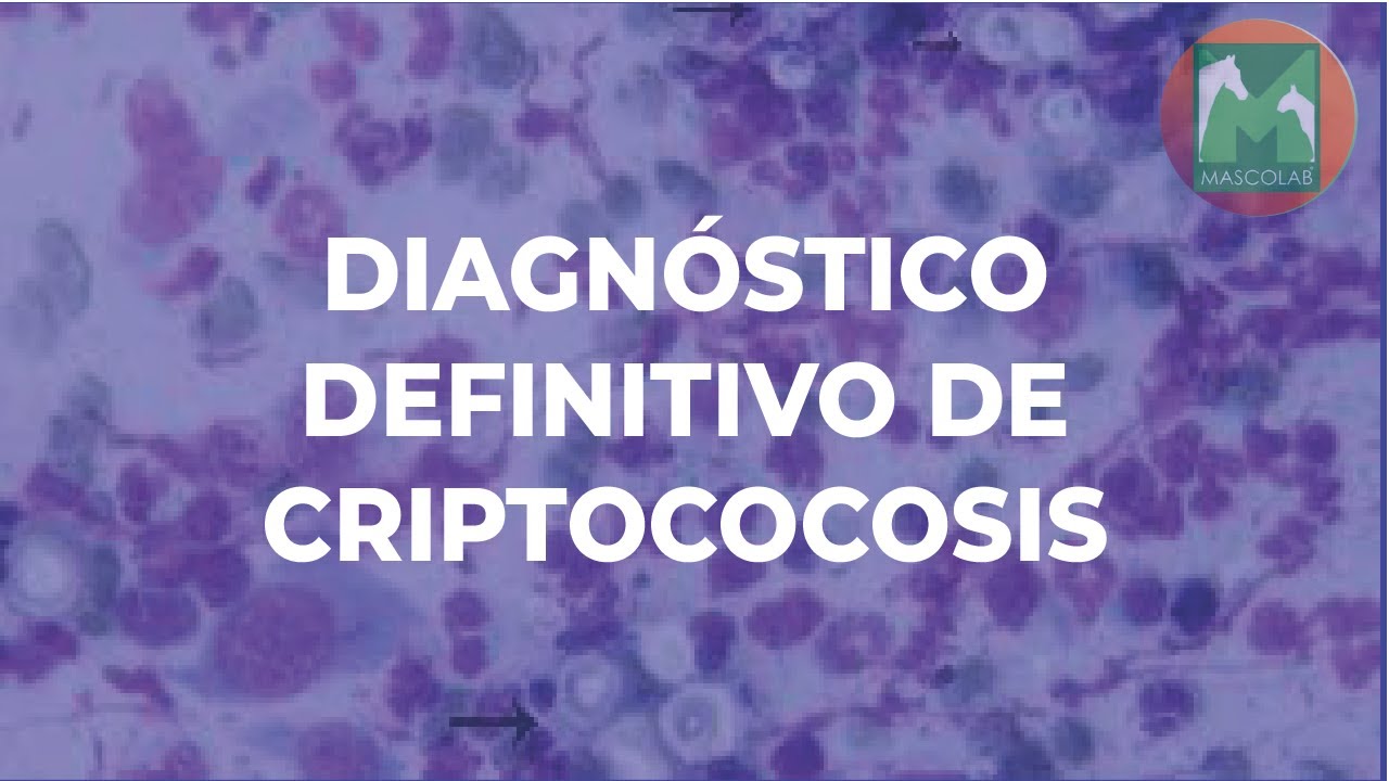 Diagnóstico de Laboratorio de Criptococosis / GUÍA DE DIAGNÓSTICO DE ...