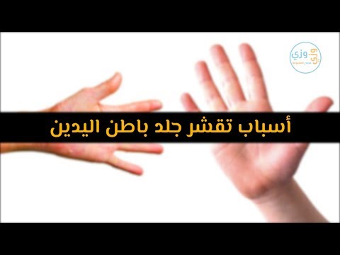 فيديو: لماذا تقشر يدي فجأة؟